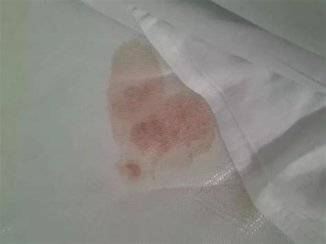 Mum's horror as she finds 'blood-stained' bed sheets in Blackpool hotel ...