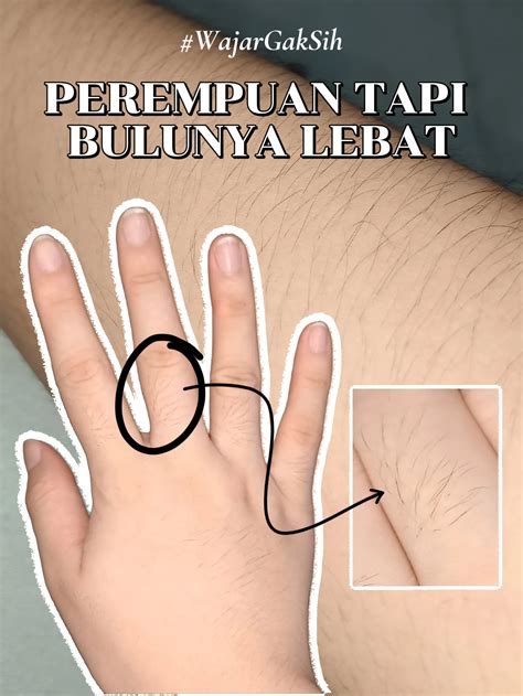 CEWEK KOK LEBAT SIH BULU TANGANNYA😕 #WAJARGAKSIH | Galeri diposting