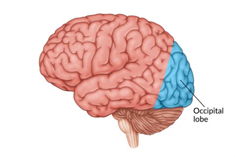 Occipital Lobe Stroke: Effects, Rehabilitation, & Outlook