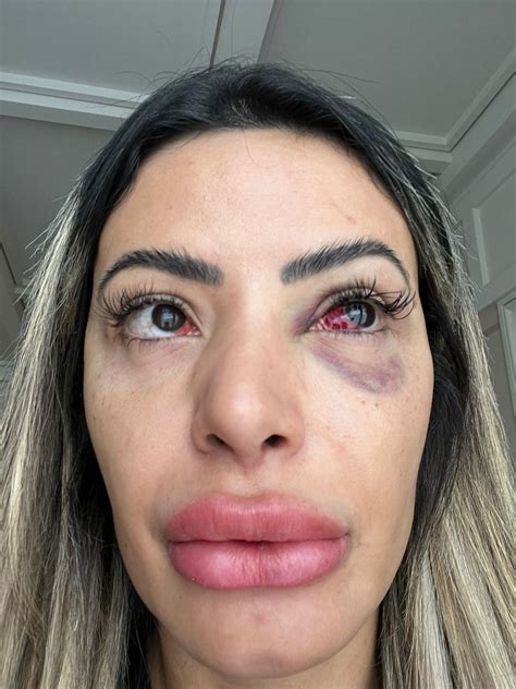 Influenciadora Janaína Prazeres sofre tentativa de feminicídio do