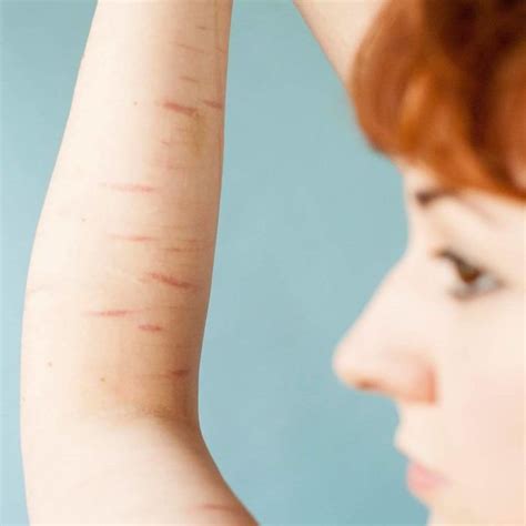 People Reveal Their Scars And How They Got Them In A Powerful Photo ...