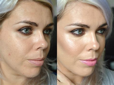 Makeup Forever Hd Foundation Acne