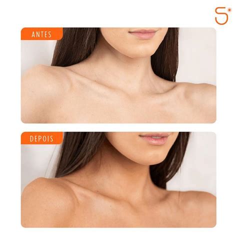 Autobronzeador Skelt Antes E Depois - Autobronzeador Mousse Dark Skelt 140ml - Farmácias São João