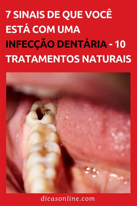 Infecção Na Gengiva Pode Matar - Infeccao Gengival Apos Extracao Dentaria