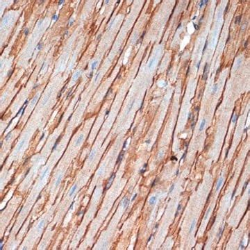 anti alpha sarcoglycan sgca antibody produced  rabbit sigma aldrich