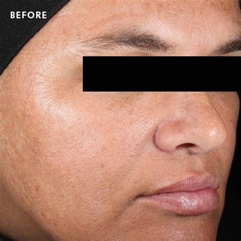 SkinCeuticals New Corrective Serum - IHASA