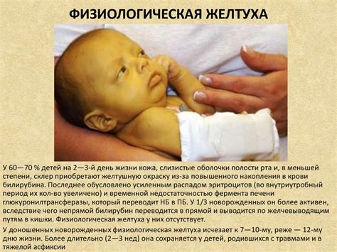 Анатомо-физиологические особенности доношенного ребенка - презентация ...
