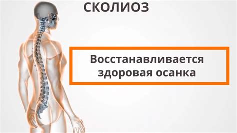 Профилактика сколиоза. Лечение искривления позвоночника без операции ...
