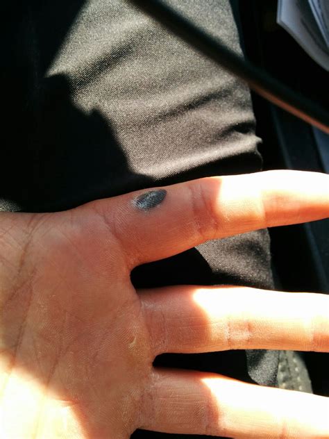 I keep getting a callus on my left index finger, could something be