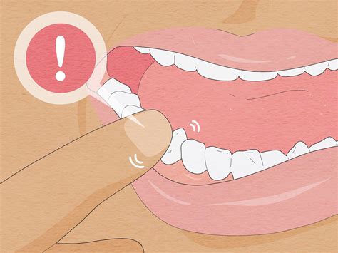 how to remove a wobbly tooth 4
