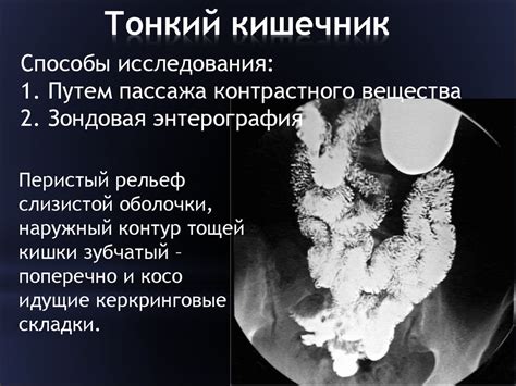 Лучевая диагностика заболеваний желудочно-кишечного тракта ...