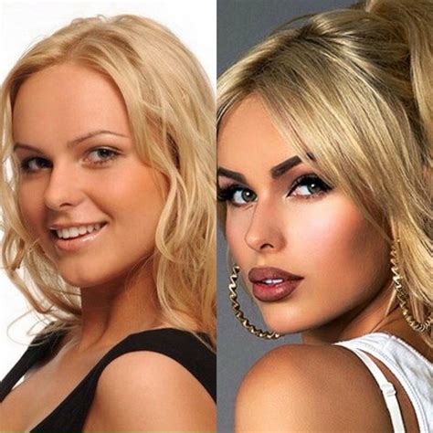 Что делала с лицом певица Ханна? До и после. Разбор внешности от врача ...