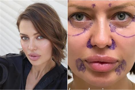 Пластический шедевр: Виктория Боня рассекретила свое обновленное лицо ...