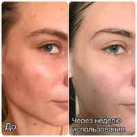 Коллаген косметический VITARINO(ВИТАРИНО) | отзывы