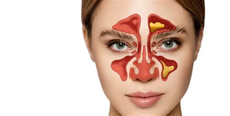 Alergia na peľ: Môžete ju získať hocikedy? - Natures