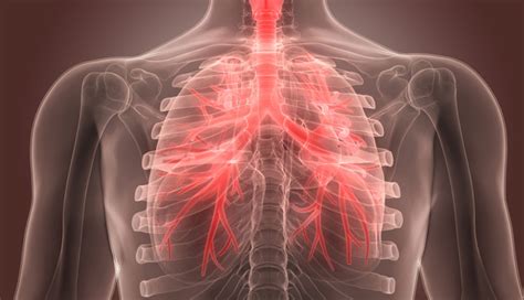 6 Most Common Causes of Chest Congestion - lifeberrys.com