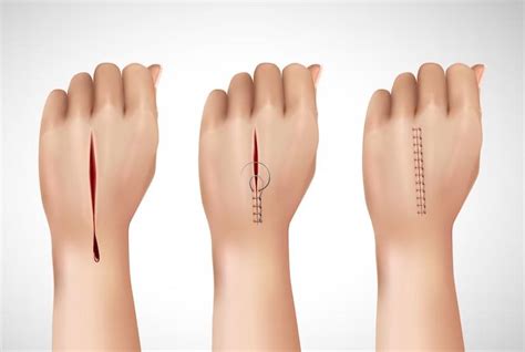 hand surgery dr sushrut tated