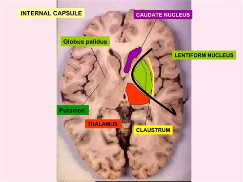 anatomy  internal capsule