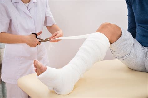 Гипс пластиковый и натуральный: минусы и плюсы | MedAboutMe