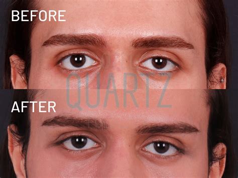 Almond Eyes Definition at Maria Medina blog