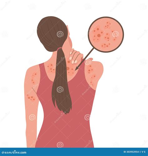 Itching Of The Skin, Infection. Hand Combing Shoulder Cartoon Vector
