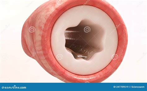 Bronchopulmonary Segmental Anatomy Stock Illustration - Illustration of ...