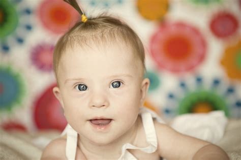 Tudo o que você precisa saber sobre Síndrome de Down | Bebe.com.br