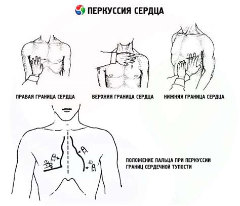 Kalp perküsyon: teknik, norm