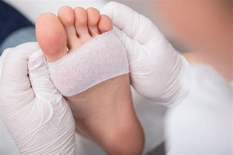 toe fractures treatment  singapore orthocare sg