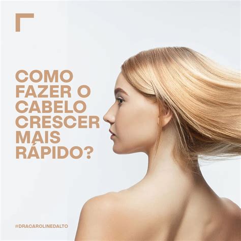 O Que Fazer Crescer Cabelo - Como fazer o cabelo crescer mais rápido? | Dermatologista em São Paulo