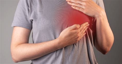 fungating breast cancer breast cancer trials