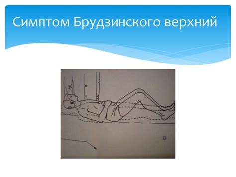 Менингит. Классификация - презентация онлайн