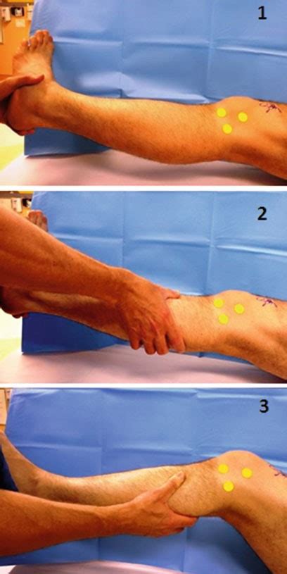 pivot shift test wikism sports medicine wiki