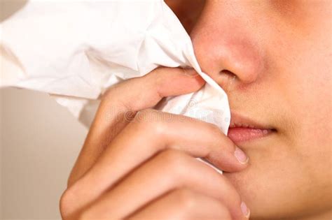 Nariz Escorrendo E Tosse - O Adolescente Tem Nariz Escorrendo, Esfregando Nariz Com Papel De ...