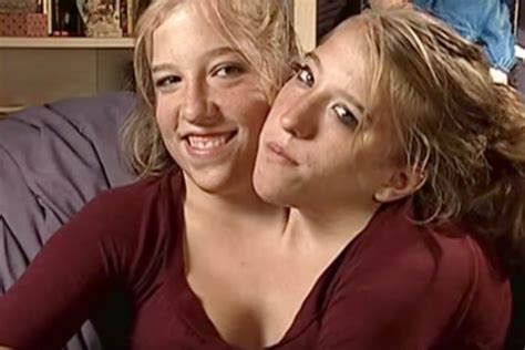 Are abby and brittany hensel conjoined twins married - lasopapersian