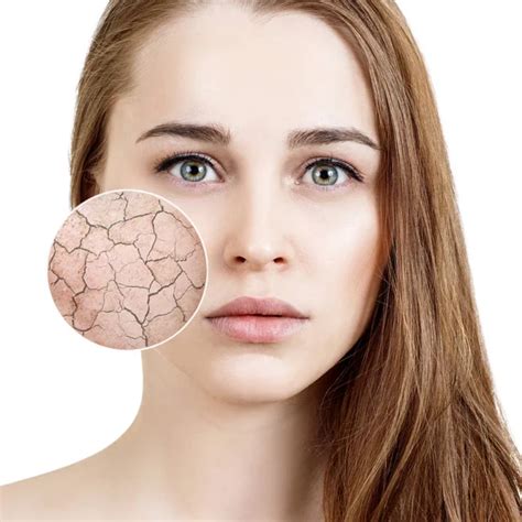 Dry skin face Stock Photos, Royalty Free Dry skin face Images ...