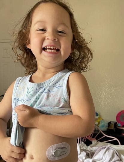Samara and Addie - Parenting of a toddler with type 1 diabetes | Dexcom