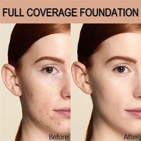 color correcting concealer for bruises 9