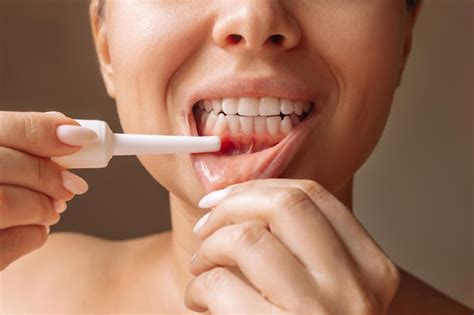 Premium Photo | Ulcerative stomatitis on the gums. Gum inflammation. Young woman applies the ...