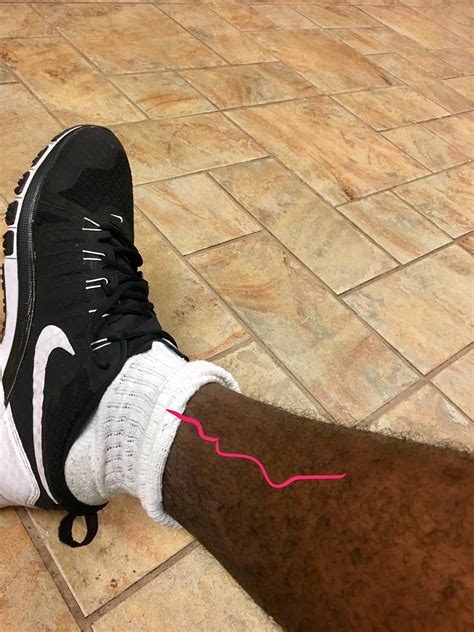 Legs Hurt After Running In Cold at Christy Calvin blog