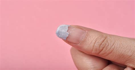 Unhas Rachadas Desde A Raiz - Como Recuperar uma Unha Rachada | UnhasEsmaltes