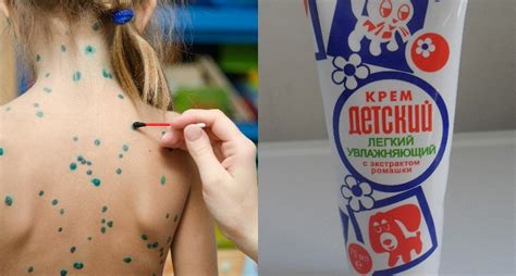 Чем отмыть зеленку
