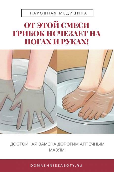 Pin on ПОЛЕЗНЫЕ НАХОДКИ СОВЕТЫ И ЗДОРОВЬЕ
