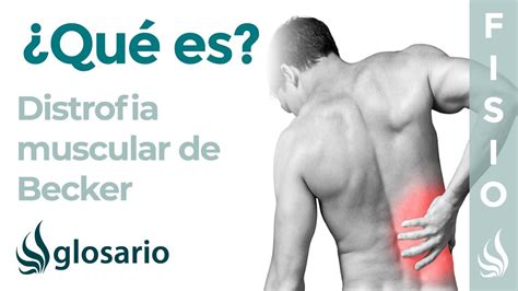 DISTROFIA muscular de BECKER | Qué es, qué estructuras afecta, síntomas ...