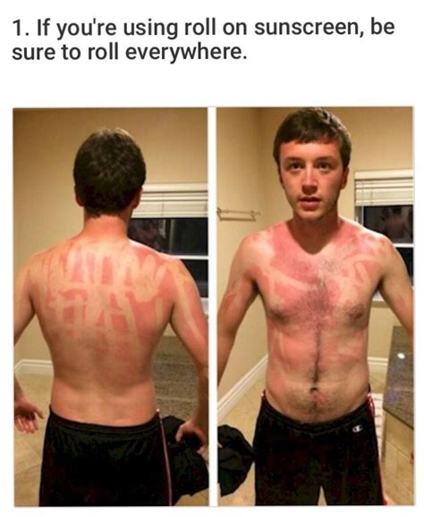 funny sunburn meme