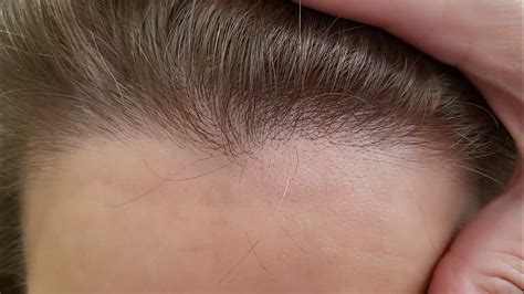 Hair coloring.Мелирование . Тонирование 10/0+9/17+8/61 Эстель принс ...