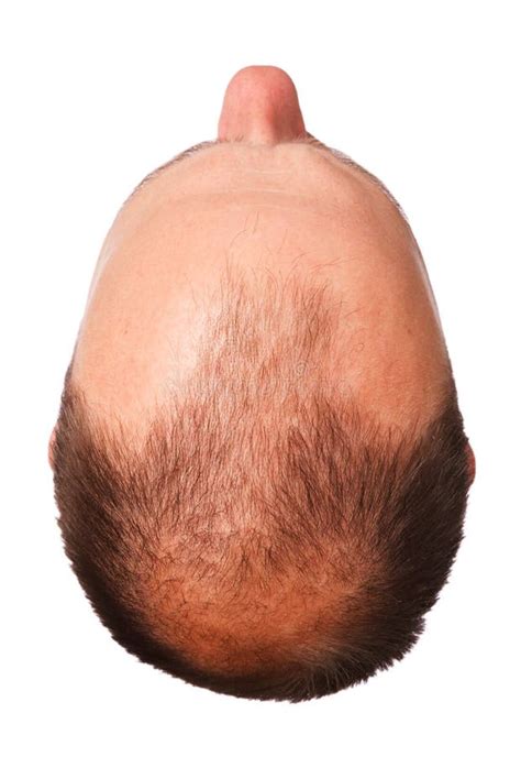 Kaal menselijk hoofd stock afbeelding. Image of hairless - 2358181