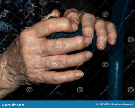 hands  caucasian elderly woman deformed  age stock photo image