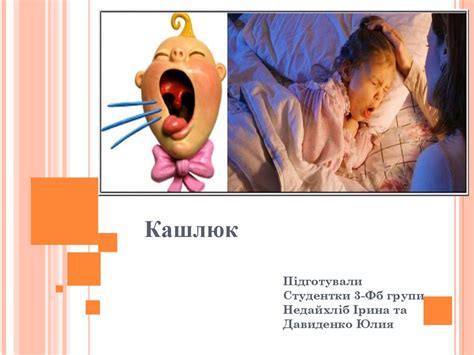 Кашлюк. Етіологія. Клініка. Лікування - презентация онлайн