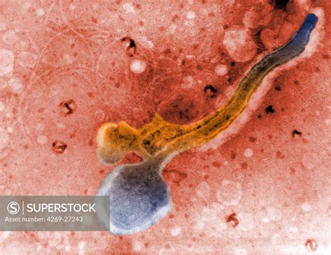 syphilis light micrograph   treponema pallidum  spirochaete